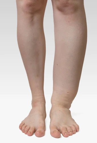 Tunga, rastlösa och svullna ben? Få sjuksköterskans gratis tips för bättre blodcirkulation. - Seniorliving